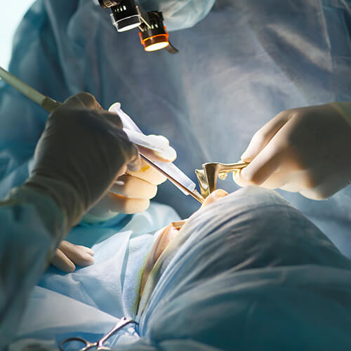 Dental Limitations Squareimage